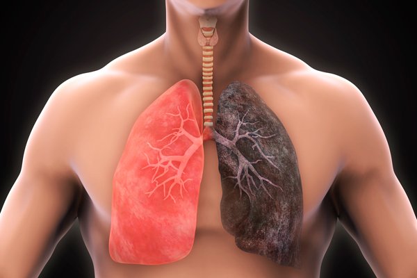 pulmones-contaminados